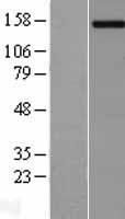 PCDH11Y Human Over-expression Lysate