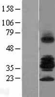 RSPO3 Human Over-expression Lysate