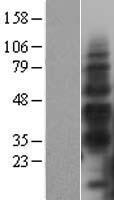TIM 3 (HAVCR2) Human Over-expression Lysate