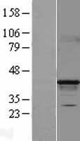 HPDL Human Over-expression Lysate