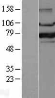 FOXP1 Human Over-expression Lysate