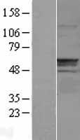CNDP1 Human Over-expression Lysate