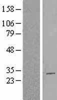 CBX2 Human Over-expression Lysate