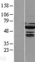 IRF5 Human Over-expression Lysate