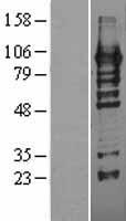 HRP2 (HDGFRP2) Human Over-expression Lysate