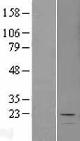 MCEE Human Over-expression Lysate
