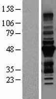 MURF3 (TRIM54) Human Over-expression Lysate