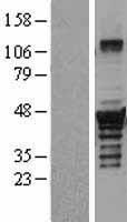 Dysbindin (DTNBP1) Human Over-expression Lysate