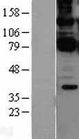 CARD11 Human Over-expression Lysate