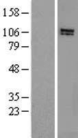 HPS3 Human Over-expression Lysate