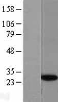 SLD5 (GINS4) Human Over-expression Lysate