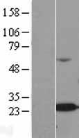 ALKBH7 Human Over-expression Lysate