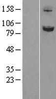 SLITRK6 Human Over-expression Lysate