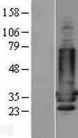 DARPP32 (PPP1R1B) Human Over-expression Lysate
