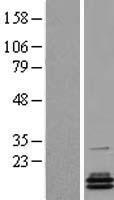 PCBD2 Human Over-expression Lysate