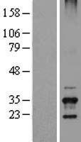 TSSK6 Human Over-expression Lysate
