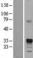Marapsin (PRSS27) Human Over-expression Lysate