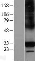 CTRP6 (C1QTNF6) Human Over-expression Lysate