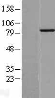BBS2 Human Over-expression Lysate