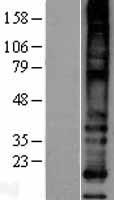 MS4A8B (MS4A8) Human Over-expression Lysate