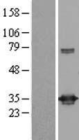 UCK (UCK1) Human Over-expression Lysate