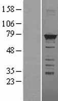 HNRPM (HNRNPM) Human Over-expression Lysate