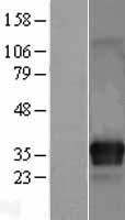 ITM2C Human Over-expression Lysate