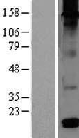 DEFB126 Human Over-expression Lysate