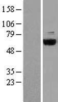 COASY Human Over-expression Lysate