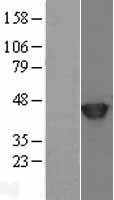SETD7 Human Over-expression Lysate