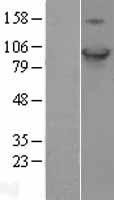 HID1 Human Over-expression Lysate