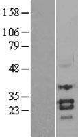 Sclerostin (SOST) Human Over-expression Lysate