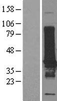 EFHD1 Human Over-expression Lysate
