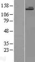 ALPK1 Human Over-expression Lysate