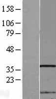 NIP30 (FAM192A) Human Over-expression Lysate