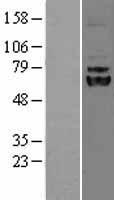LPCAT1 Human Over-expression Lysate