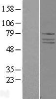 ADCK4 (COQ8B) Human Over-expression Lysate