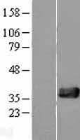 NUDT18 Human Over-expression Lysate