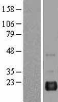 BAALC Human Over-expression Lysate