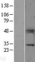 B7H4 (VTCN1) Human Over-expression Lysate