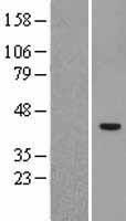 SUV39H2 Human Over-expression Lysate