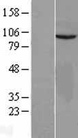 VEPH1 Human Over-expression Lysate