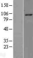 RHBDF2 Human Over-expression Lysate