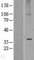 Adiponectin Receptor 2 (ADIPOR2) Human Over-expression Lysate