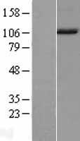 NARG1L (NAA16) Human Over-expression Lysate