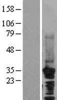 HRPT2 (CDC73) Human Over-expression Lysate