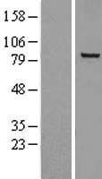 NOX5 Human Over-expression Lysate
