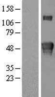 KREMEN2 Human Over-expression Lysate