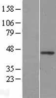 WNT2B Human Over-expression Lysate