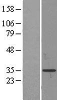 ProDynorphin (PDYN) Human Over-expression Lysate
